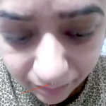 Quick recovery in 3 days- Case of CSF Rhinorrhea from Patiala